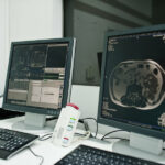 centre radiologie imagerie medical vevey suisse infiltration